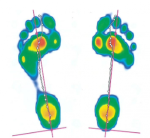 Footscan plantar pressure data